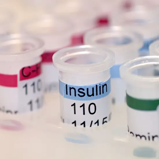 Insulin, Free (Bioactive)